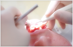 一般歯科ではあつかわない口腔内のあらゆる疾患に対応しています。